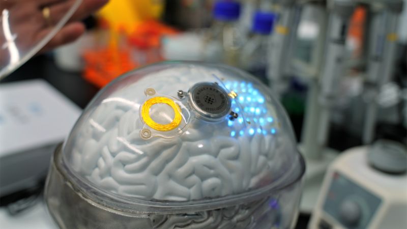 Advancements in Brain Technology: China's Rise as a Global Competitor