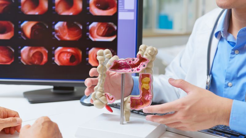 Rise in Colorectal Cancer Cases Among Young Adults