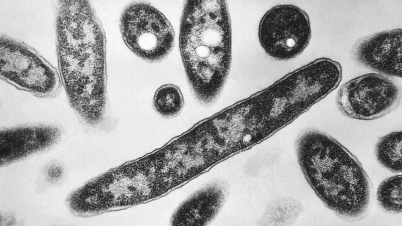 Legionnaires' Disease Outbreak in New York City