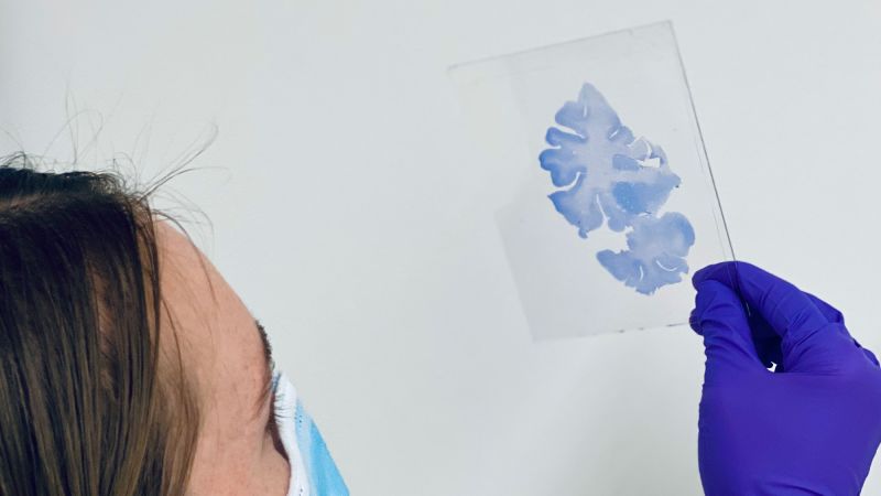 Unlocking the Secrets of SuperAgers: Insights into Exceptional Cognitive Functioning