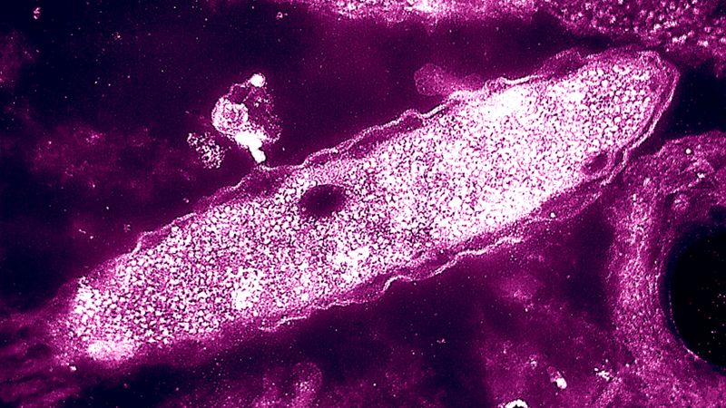 Legionnaires' Disease Outbreak in Central Harlem