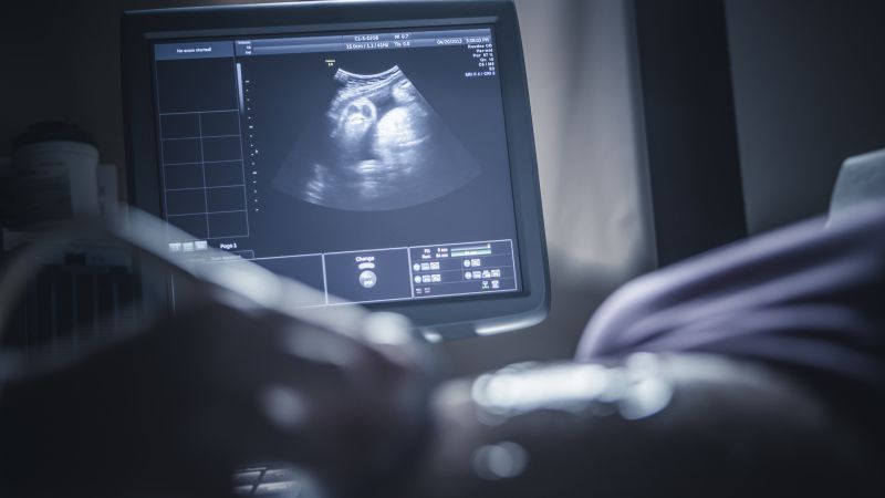 American College of Obstetricians and Gynecologists Endorses Covid-19 Vaccination During Pregnancy