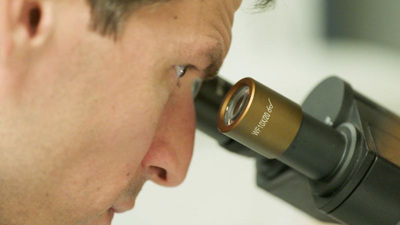 Man Defies Medical Odds and Finds Solution for Condition