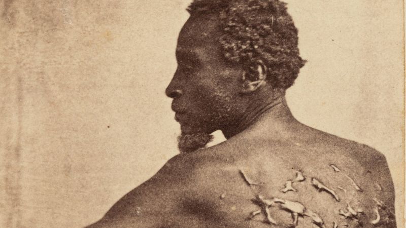 Historical 'Scourged Back' Image Sparks Censorship Debate in America