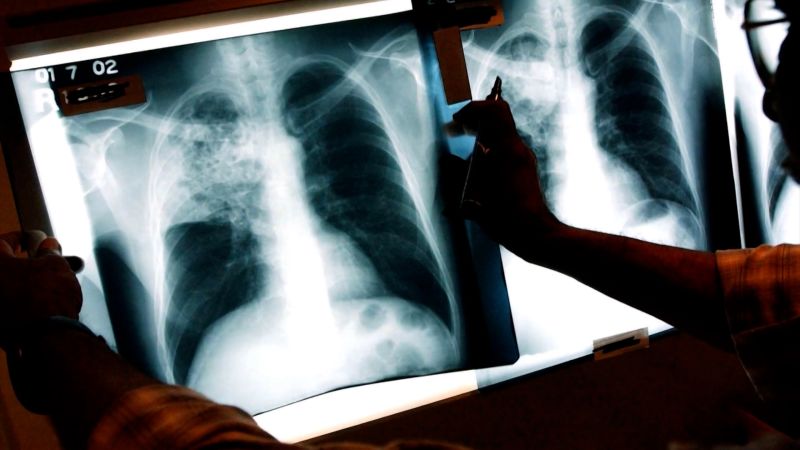 Revolutionizing Healthcare with AI Predictive Tools